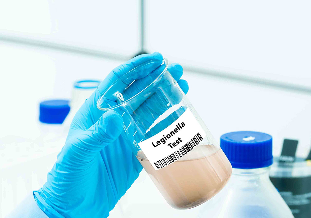 Prevenção e controlo de Legionella